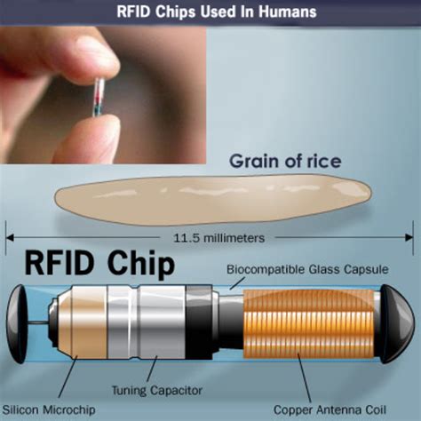 Rfid tracking chip